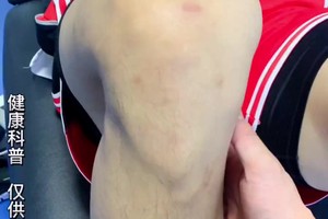  职业篮球运动员的休息与恢复技巧：提升表现的关键